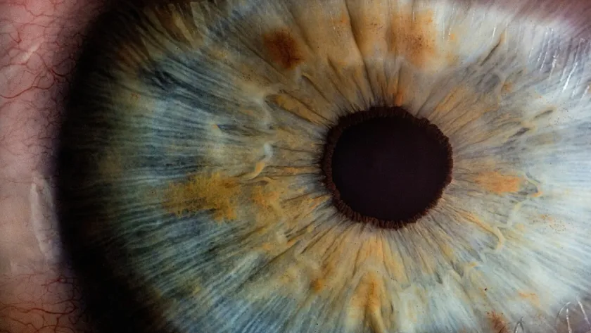 Photo d'un oeil pour le thème Attention aux yeux